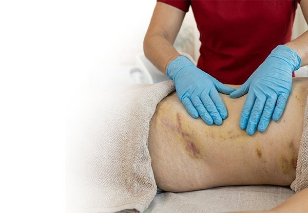 Post-op lymphatic massage in Miami Beach